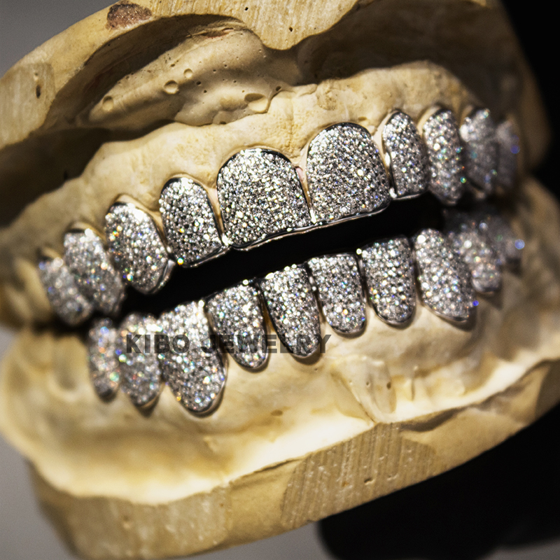 Custom Moissanite Diamond Grillz